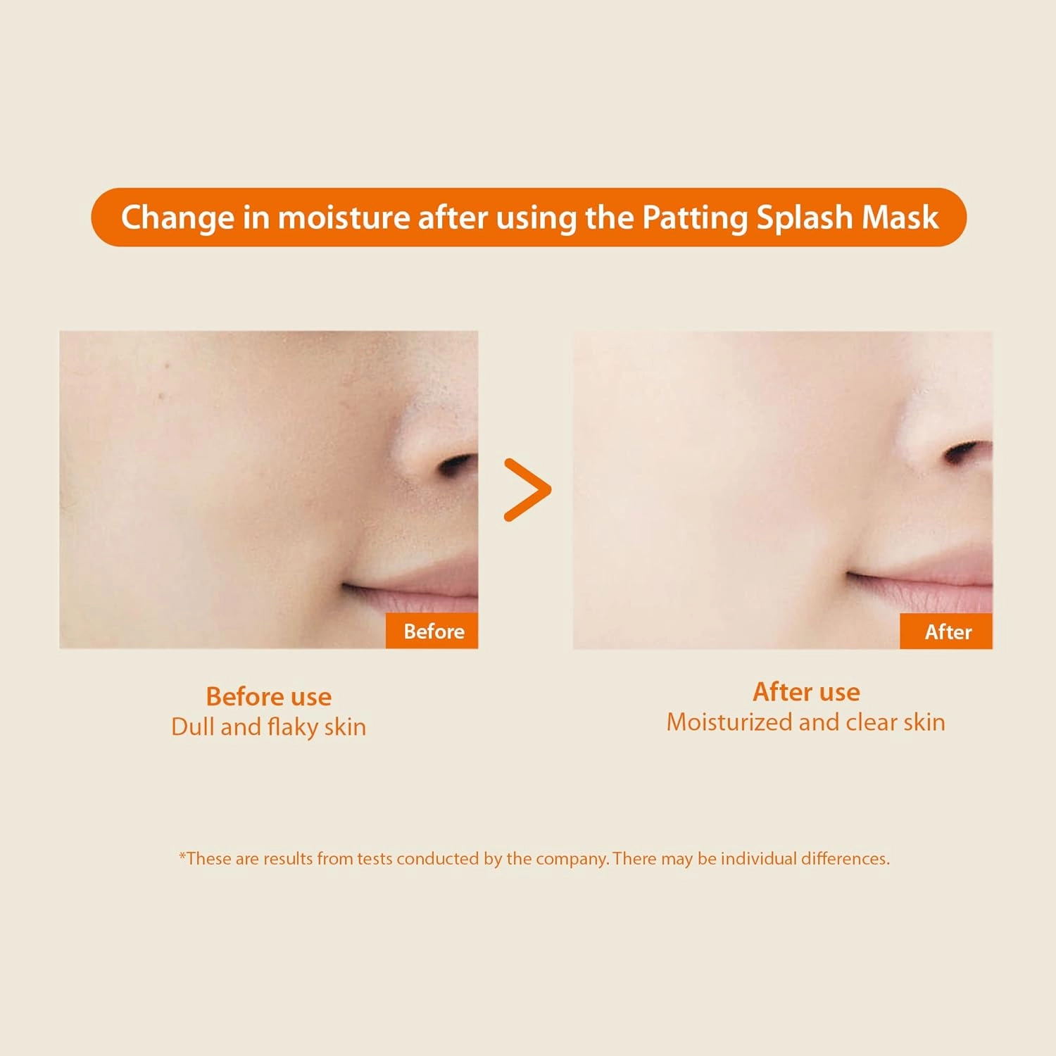 BLITHE Patting Splash Mask Exfoliating Face Wash with Yellow Honey - Korean Chemical Exfoliant for Face AHA Lactic Acid for Dark Spots, Energy Citrus for Skin Brightening & Radiance 5.07 Fl Oz
