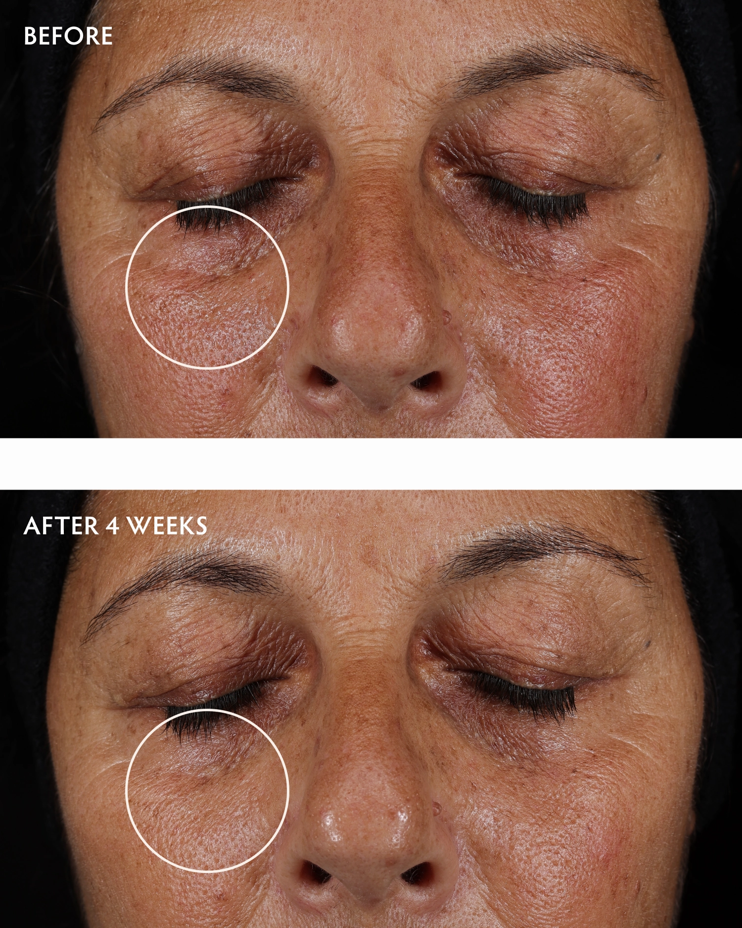 Caffeine   Peptide Smoothing Eye Serum