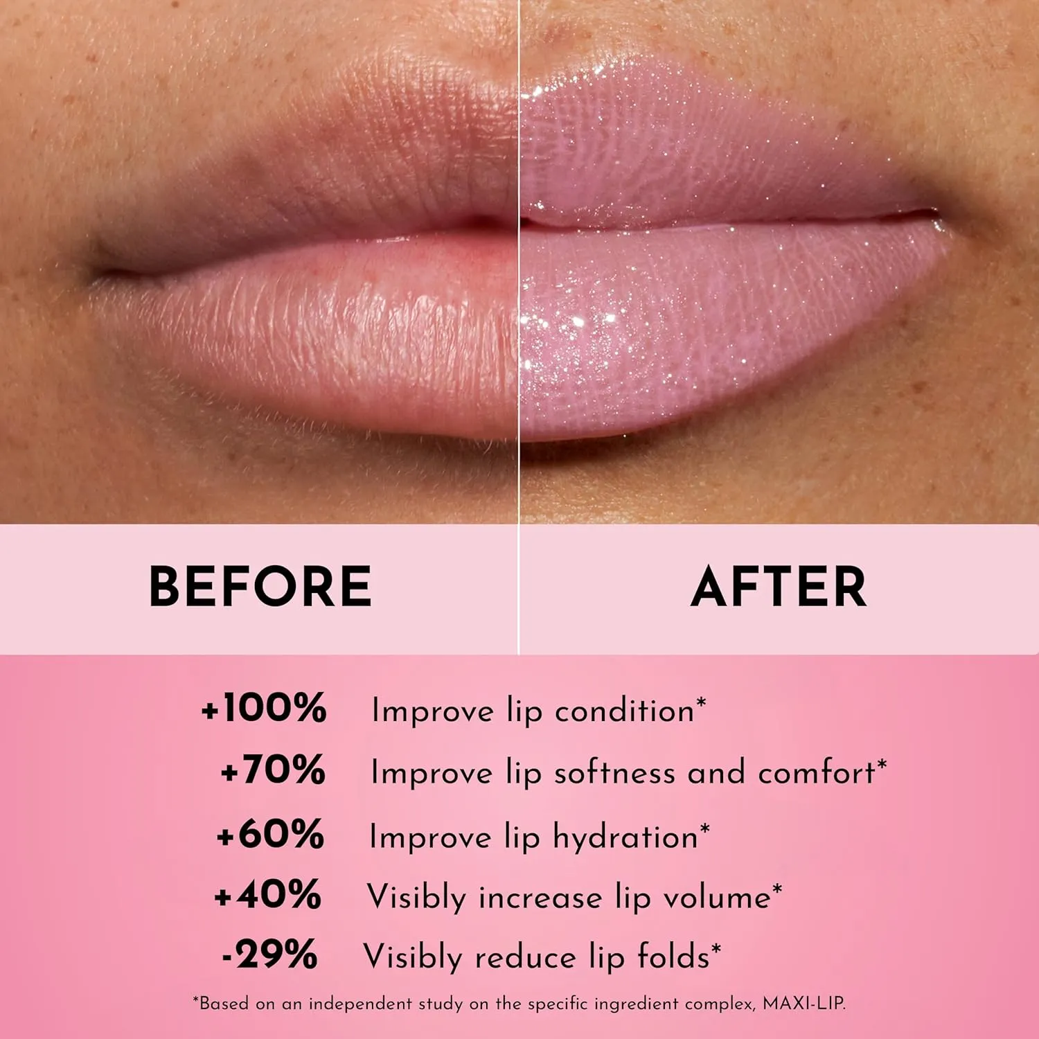 Forget the Filler Lip Plumping Line Smoothing Gloss - Daisy Girl - Premium Volumizing Lip Gloss with Natural Ingredients Designed to Plump, Firm, and Hydrate Lips 0.11 oz