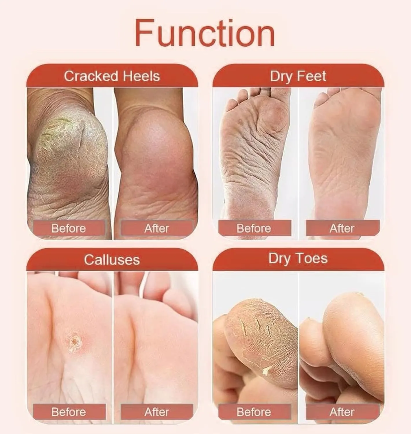 Maraly Foot Peeling Mask (2 Pairs) - Natural Ingredients, Removes Dead Skin & Calluses, Baby Soft Feet in 1 Week, 2-Pack, Exfoliating Foot Care Treatment for Men & Women (Peach) (2 pack)