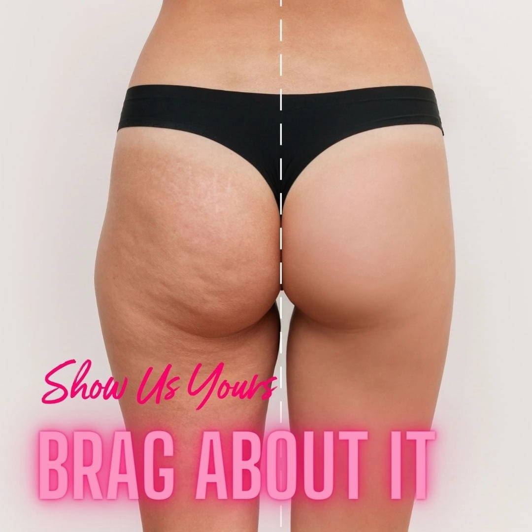 NEW Cellulite Glycolic Body Scrub Mini-Berry My Butt Smoothie