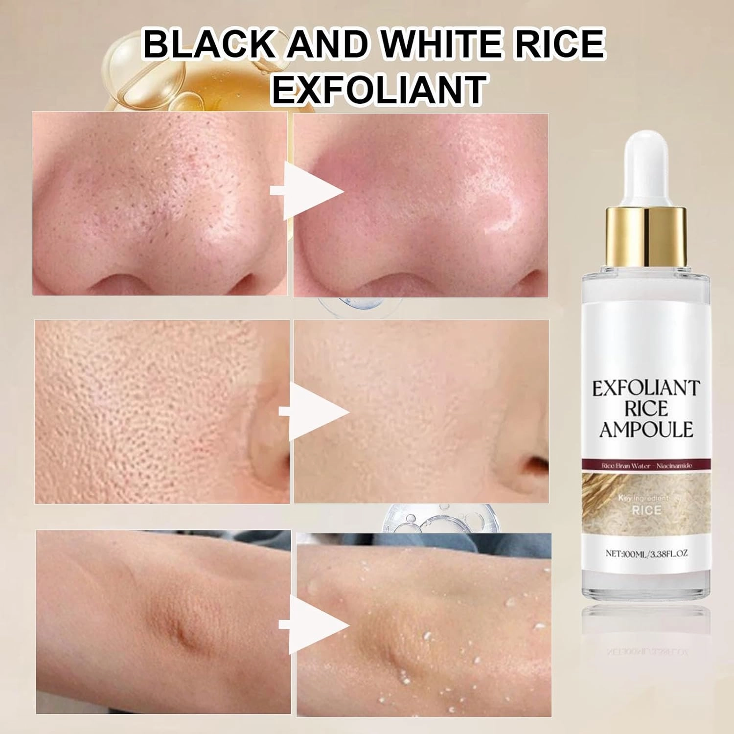 Peel Shot Glow Rice Ampoule Duo, Peel Shot Black Rice Duo, Black and White Rice Exfoliant, Rice Exfoliator for Face, For all Skin. (White Black, 6.76 Fl OZ.)