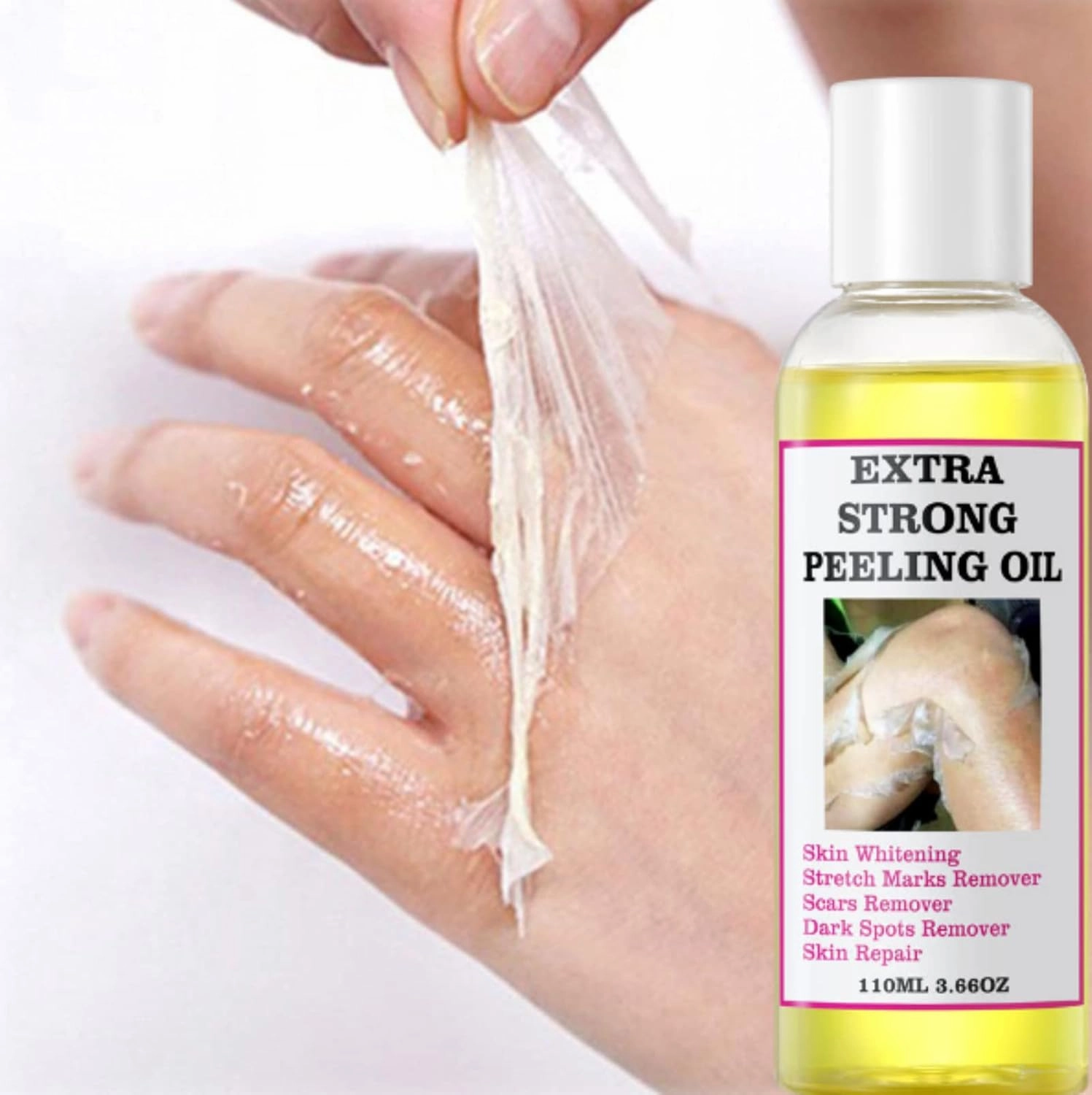 Yellow Peeling Oil - Strong Exfoliating Solution for All Skin Types - Dead Skin Remover (220ML/7.76 OZ)