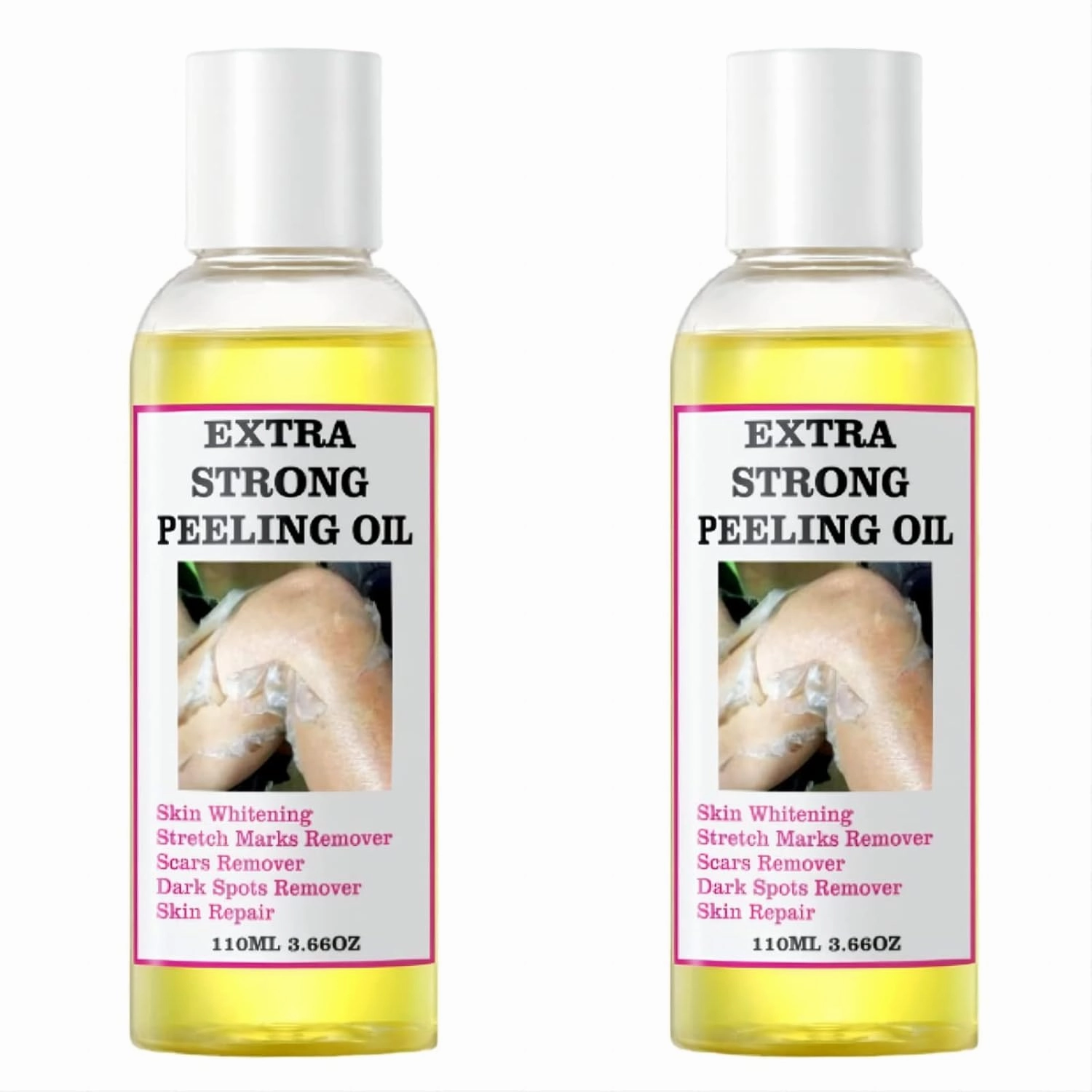 Yellow Peeling Oil - Strong Exfoliating Solution for All Skin Types - Dead Skin Remover (220ML/7.76 OZ)
